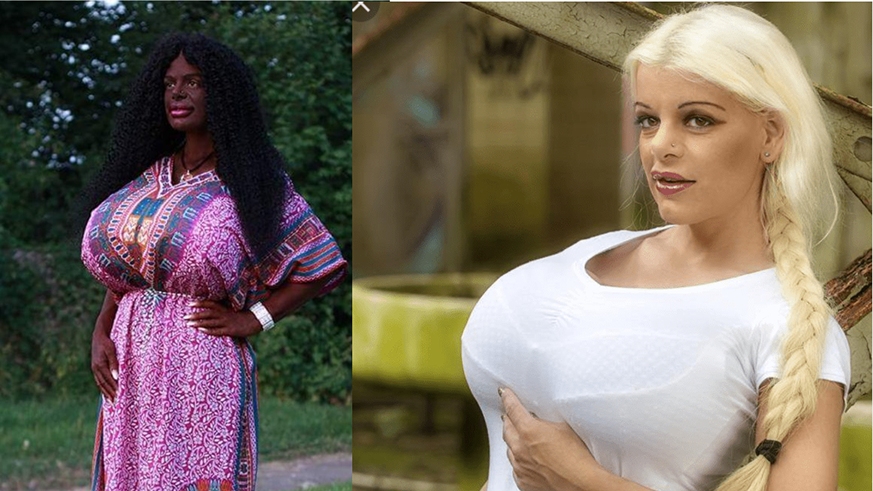 Martina Big is a German model and actress known for her body modifications. Right is before she modified herself. Photo/courtesy.