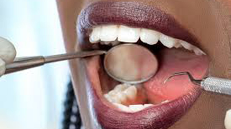 Regular visits to the dentist will keep teeth healthy. / Net photo 