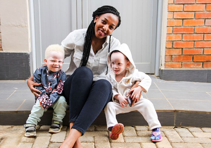 The young lady seating in the middle of two children is: Chantal Mutavu, UNDP staff seating with two albino children during their health screening.