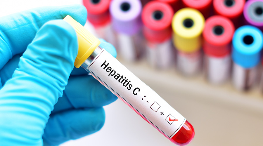 The Ministry of Health proposed a plan aimed at eliminating Hepatitis C virus (HCV) in the country within five years.
