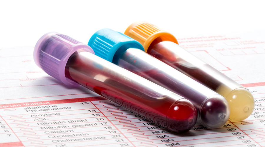 Blood disorders diagnosis is done through a combination of tests. 