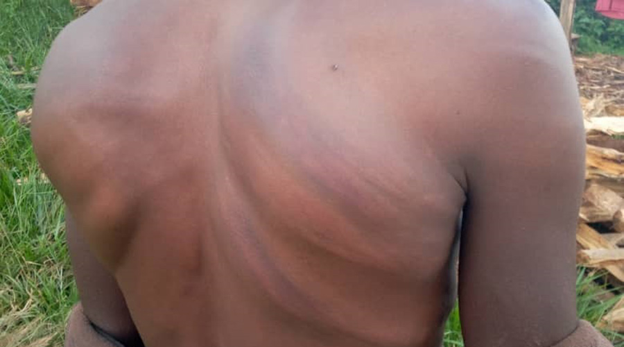 Nsengiyumva was mostly beaten on the back by UPDF officers.