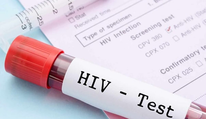 There are many advantages to being tested. People who are found to be living with HIV can be linked to immediate offer of antiretroviral therapy. / Photo: Net