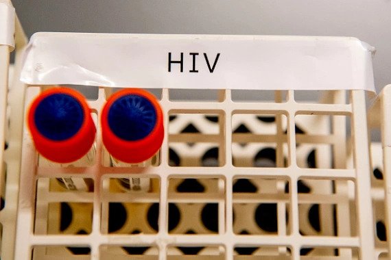 Gene therapy may be the key to an HIV cure. 
