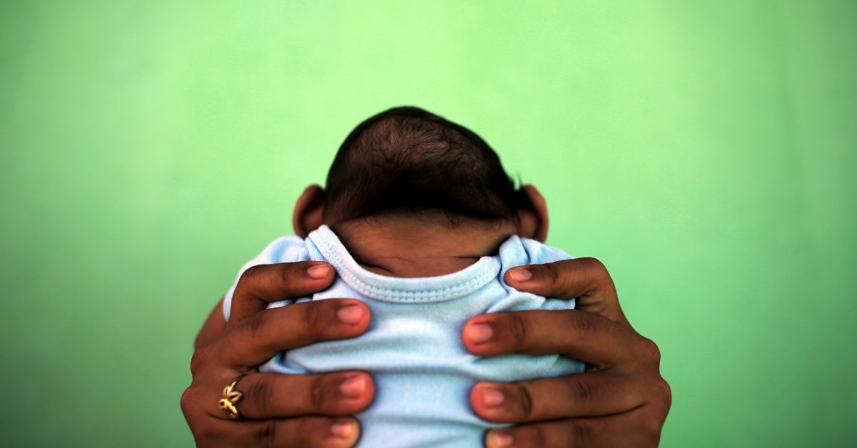 Microcephaly is a birth defect where a babyu2019s head is smaller than expected.  Photo/Net