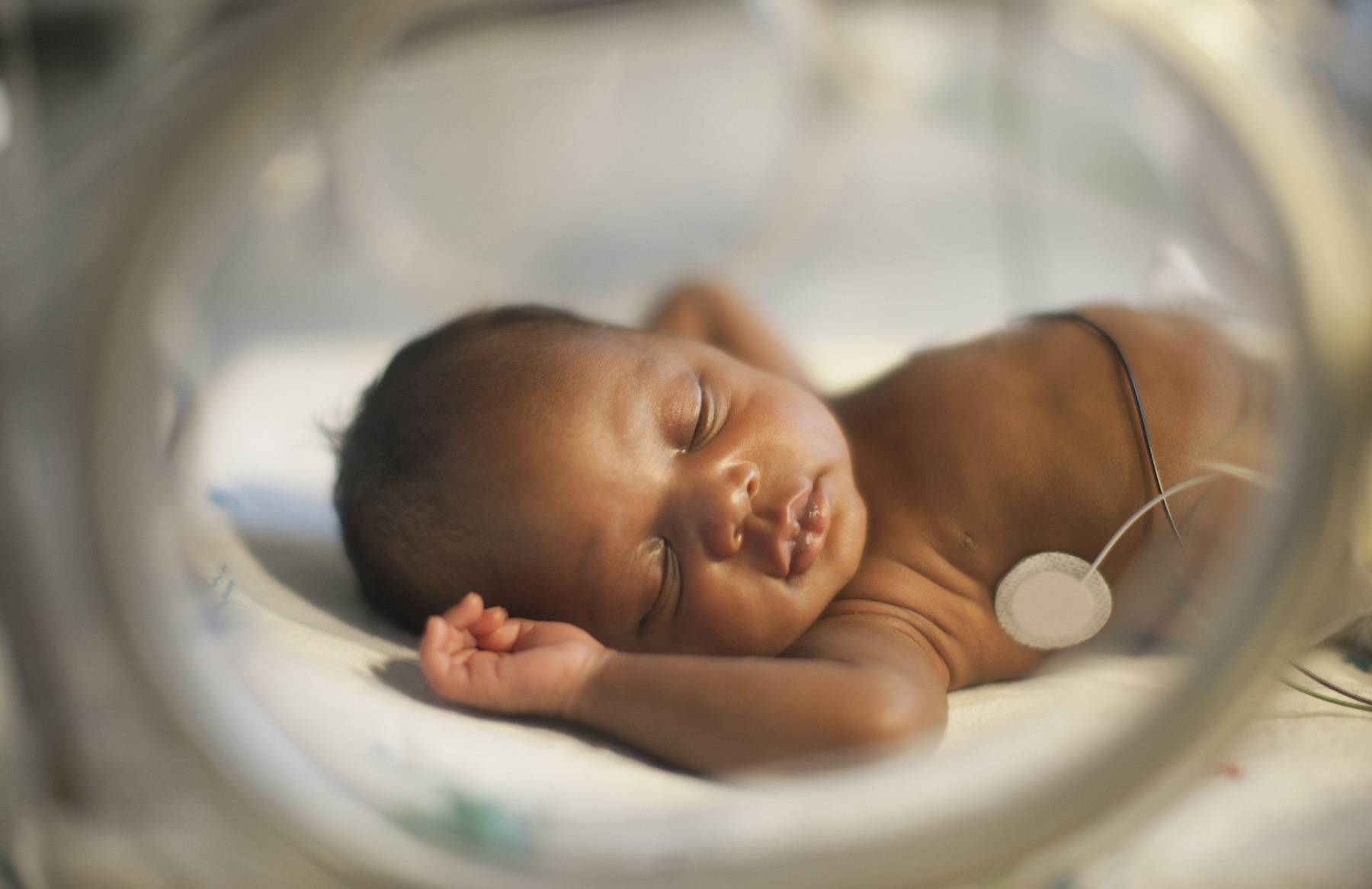 A baby with low birthweight may be at increased risk for complications. Photo/Net
