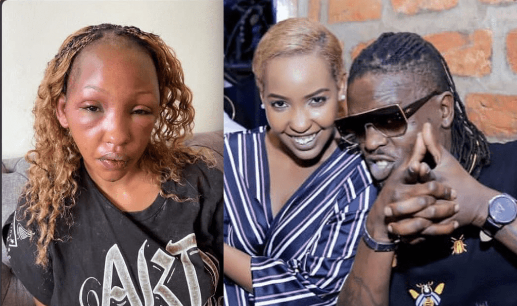 A picture of a reportedly battered Sandra Teta (L) and the socialite with singer Weasel who is said to have beaten her on several occasions.