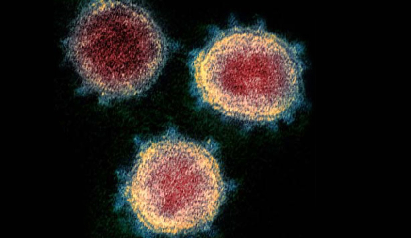 Real image of SARS-CoV-2 virions taken by cryoelectron microscopy. US National Institute of Allergy and Infectious Diseases (NIAID).